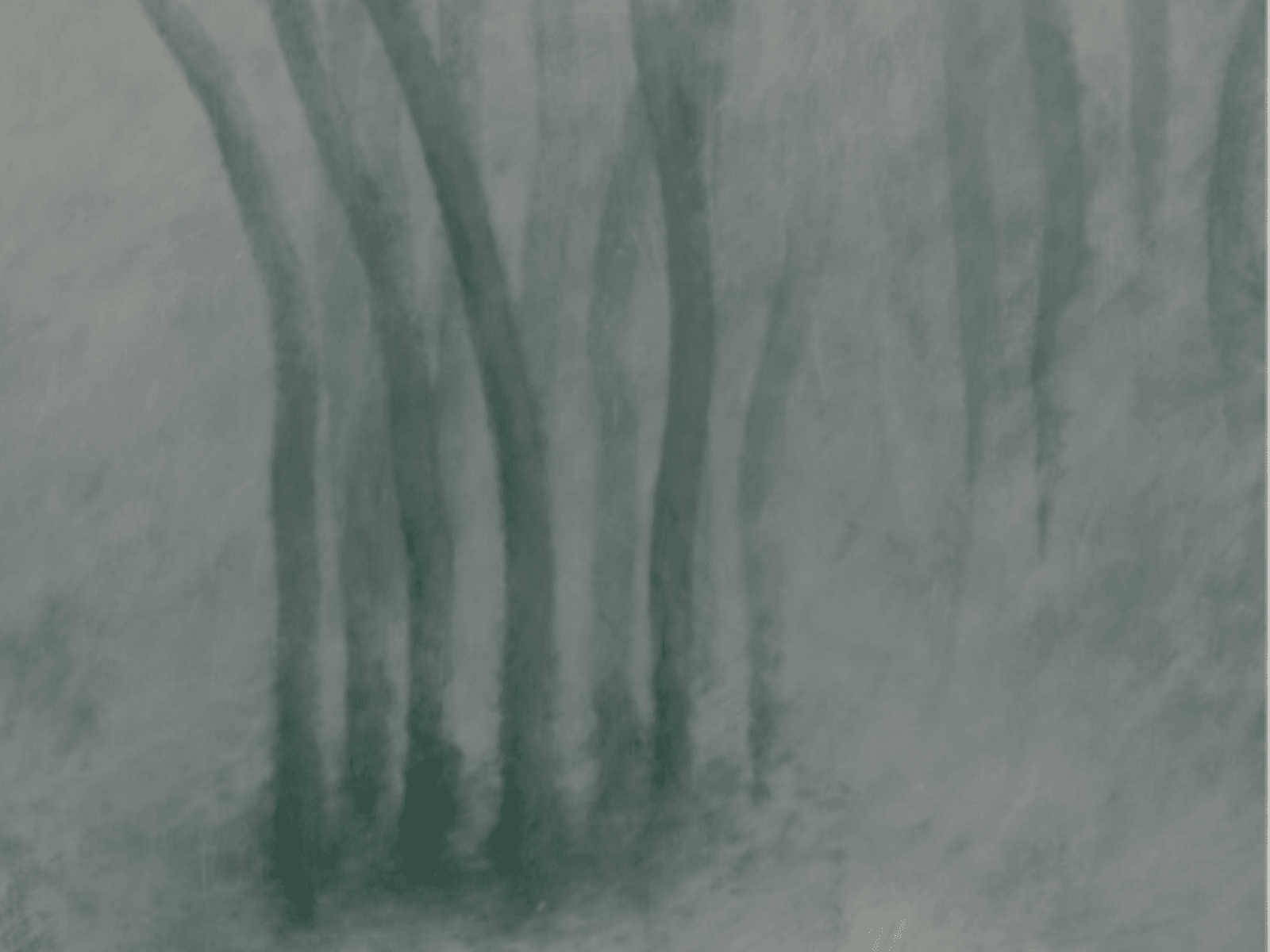 Elizabeth Tibbetts: Shelled