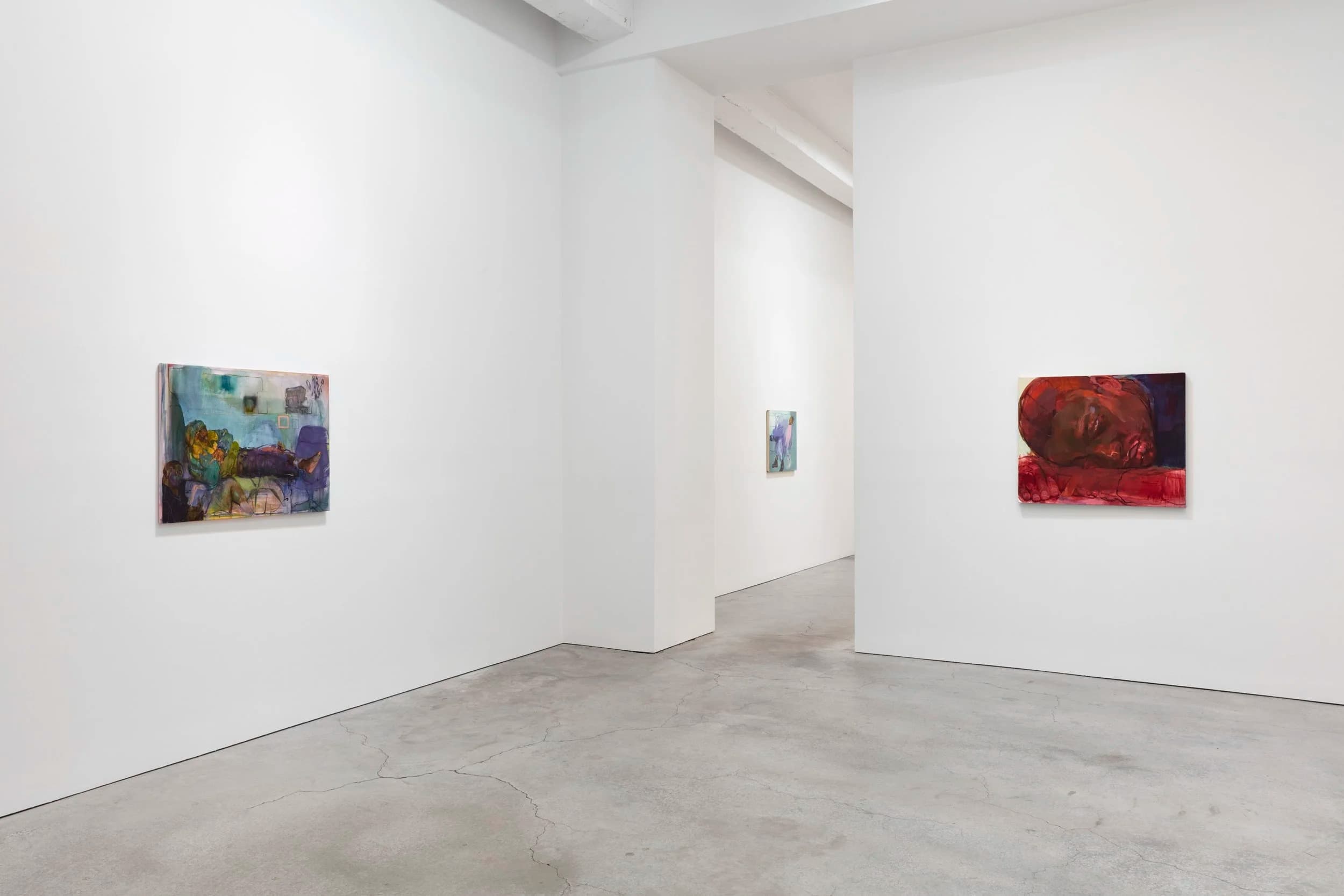 Installation view