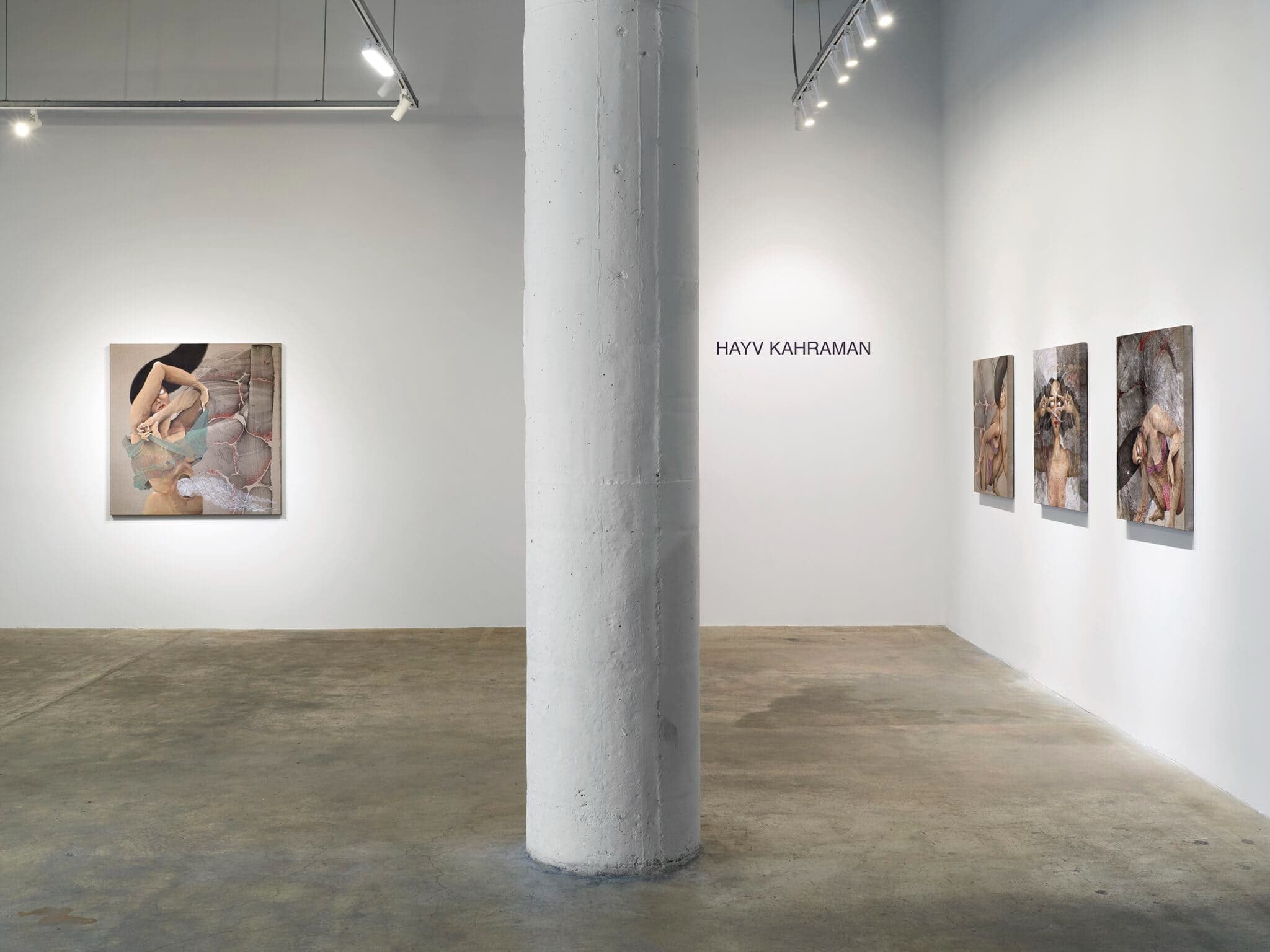 Installation view