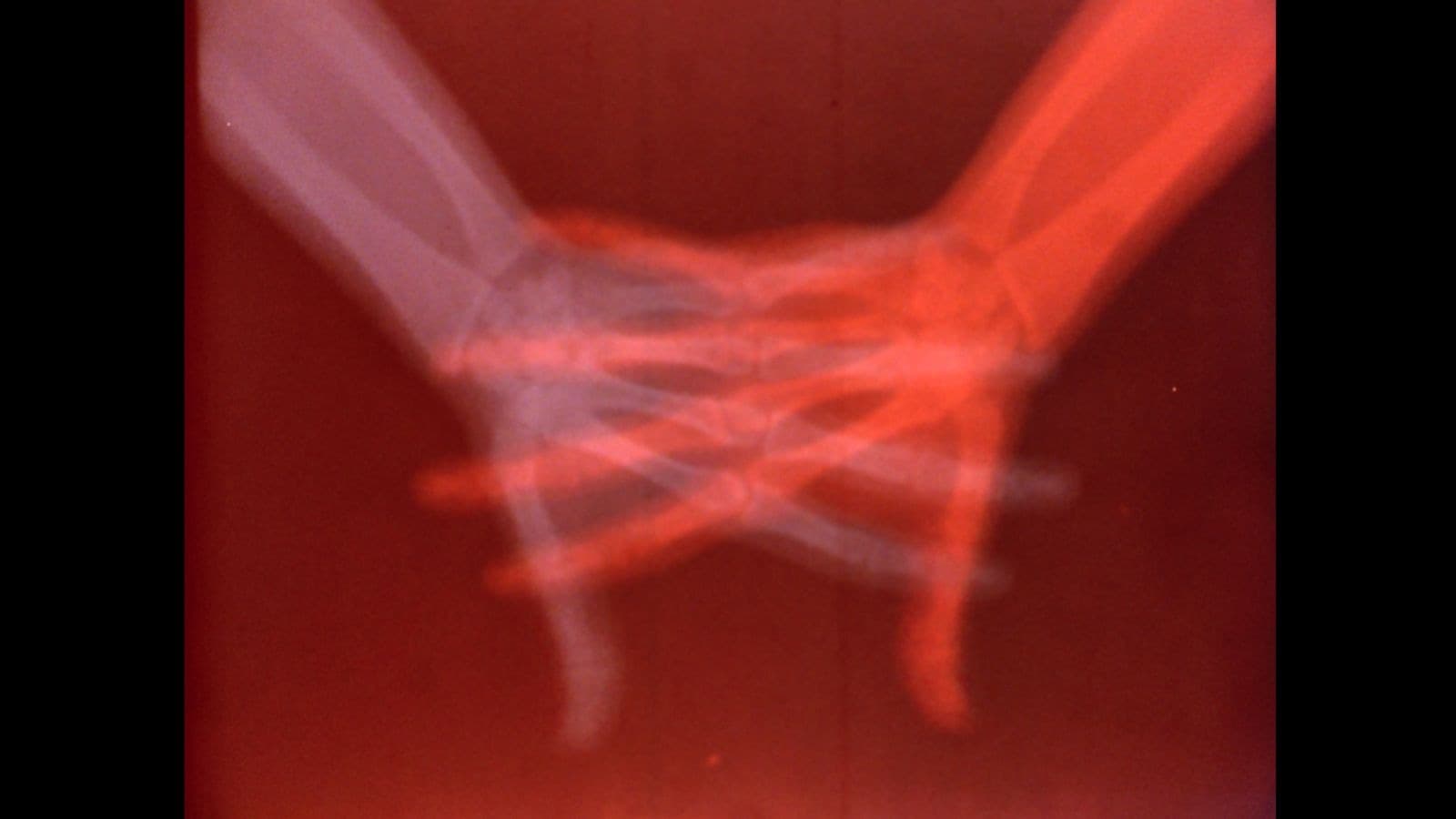 Overexposed: Art, Technology, and the Body